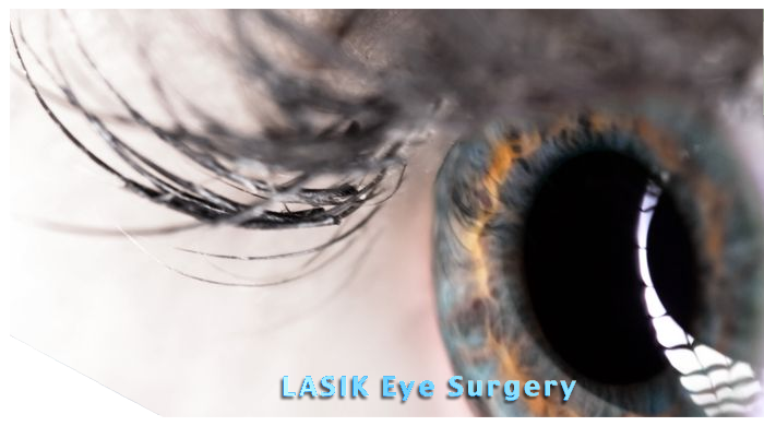 LASIK eye surgery services in Corona
